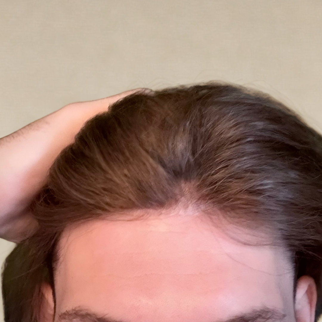Full Thin Skin Hair System — Light Brown
